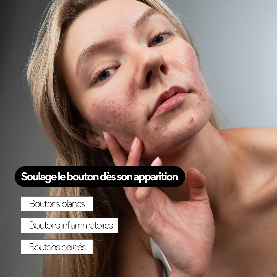 Soin anti-boutons aux prébiotiques - SKIN & OUT – Image 5